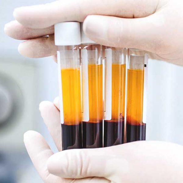 Já-ouviu-falar-em-PRP-plasma-rico-em-plaquetas