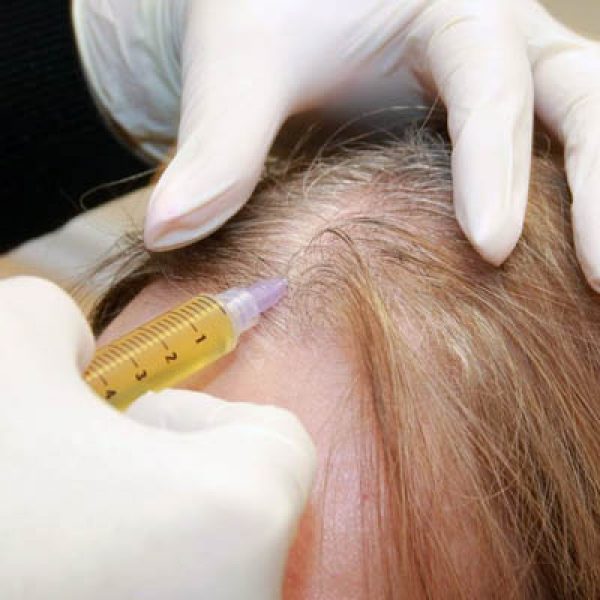 Tratamento-Capilar-em-Santos-Dica-01