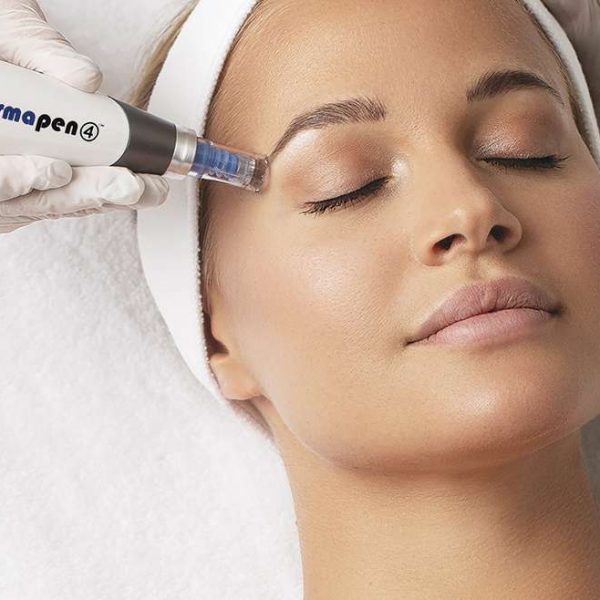 microagulhamento-997x658